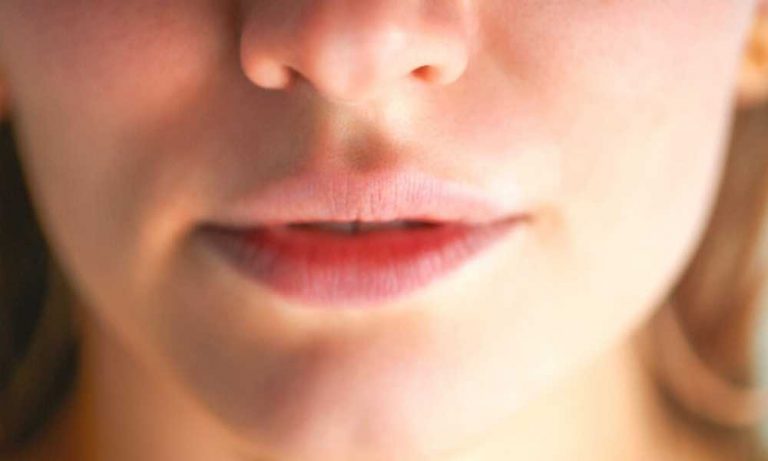 What Should You Avoid After Juvederm?