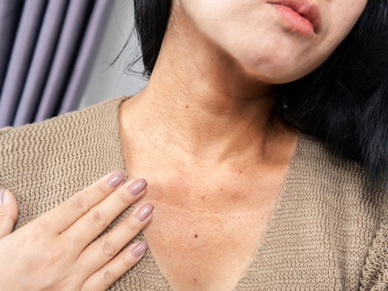 Don’t Forget Your Neck and Chest: Prevent Aging with Targeted Treatments at LUX ~ A Medical Spa in Hilton Head & Bluffton, SC