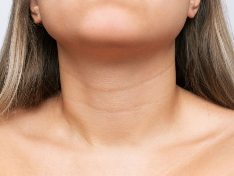 Reduce Neck Wrinkles with Botox in the Platysma Bands at LUX A Medical Spa in Hilton Head & Bluffton, SC