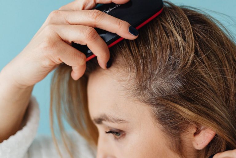 How Scalp Health Impacts Hair Loss  –  and What You Can Do About It