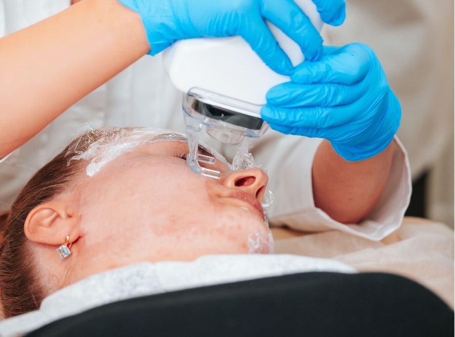 skin tightening and resurfacing at lux ~ a medical spa